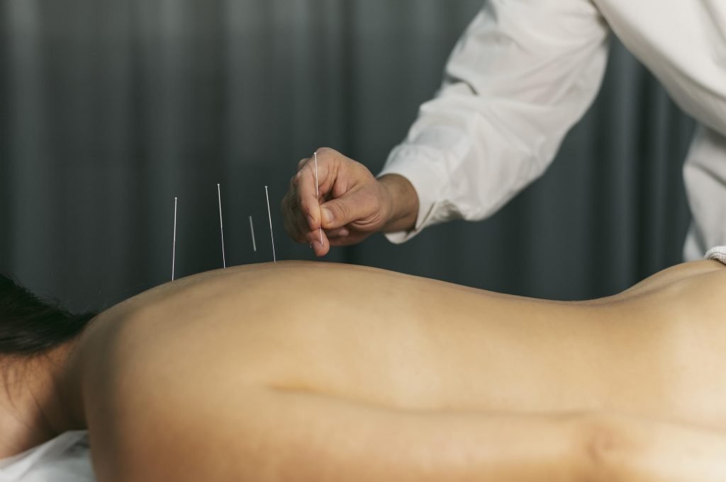 Acupuncturist in Etten-Leur